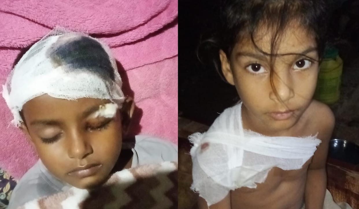 Kanpur Dogs bit 30 people in three days villagers killed one becoming aggressive due to infection