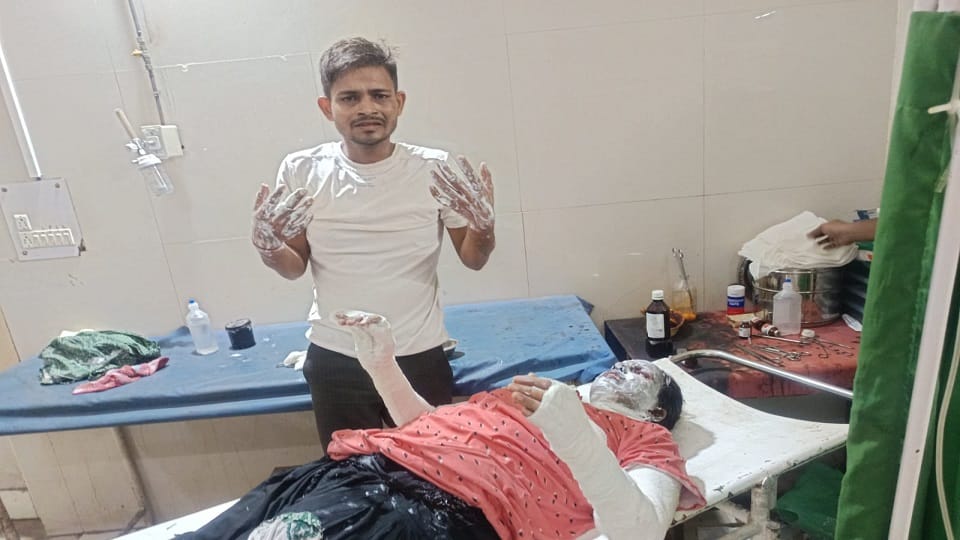 Woman Sets Herself on Fire After Argument With Husband, Referred to Agra in Critical Condition