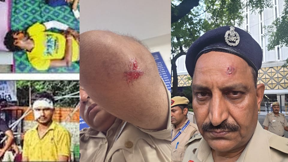 Jantar Mantar Violence Protesters Injured by Pellet Gun Shots After Delhi Demonstration