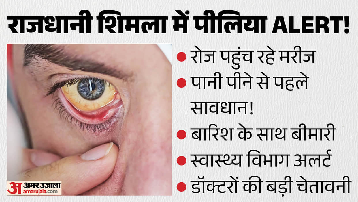 shimla jaundice alert igmc waterborne disease monsoon 2026