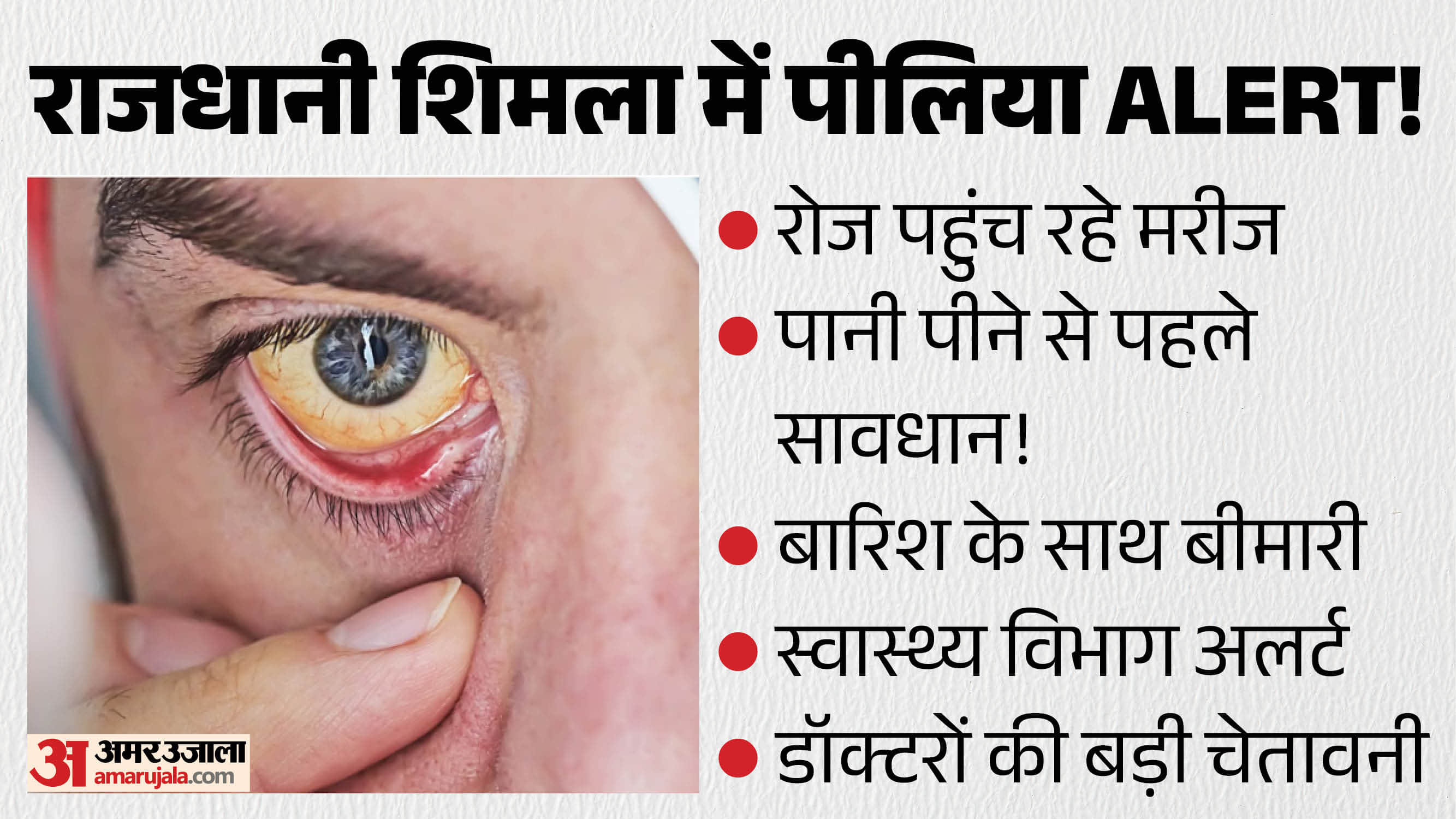 शिमला में पीलिया का अलर्ट।