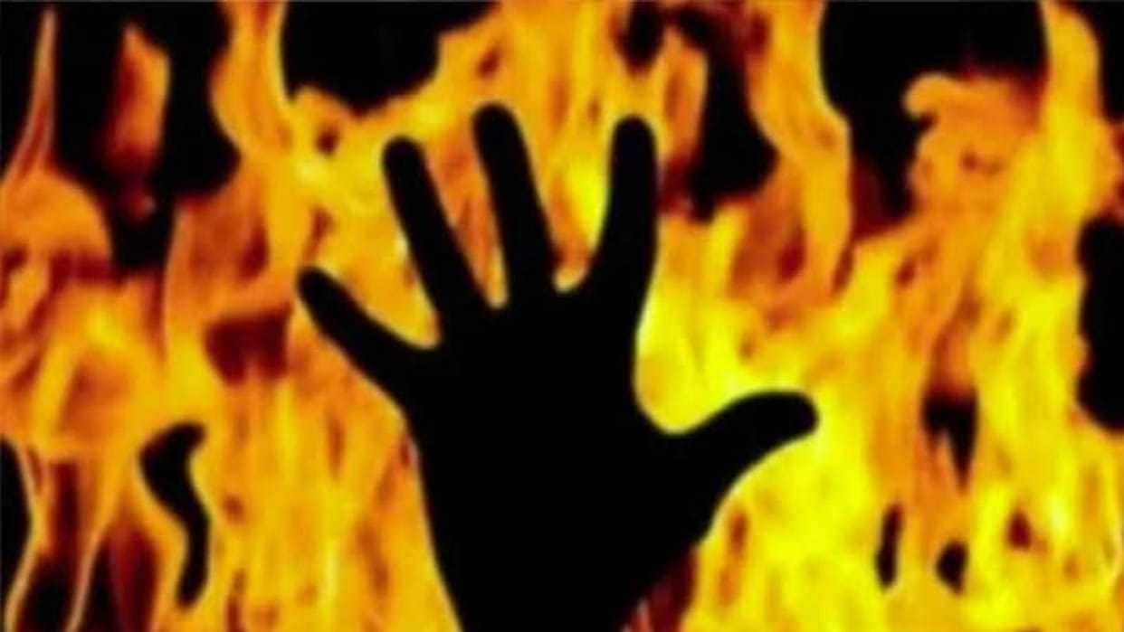 Video of a partially burnt young man goes viral; he says he was called to a house, doused with petrol, and set