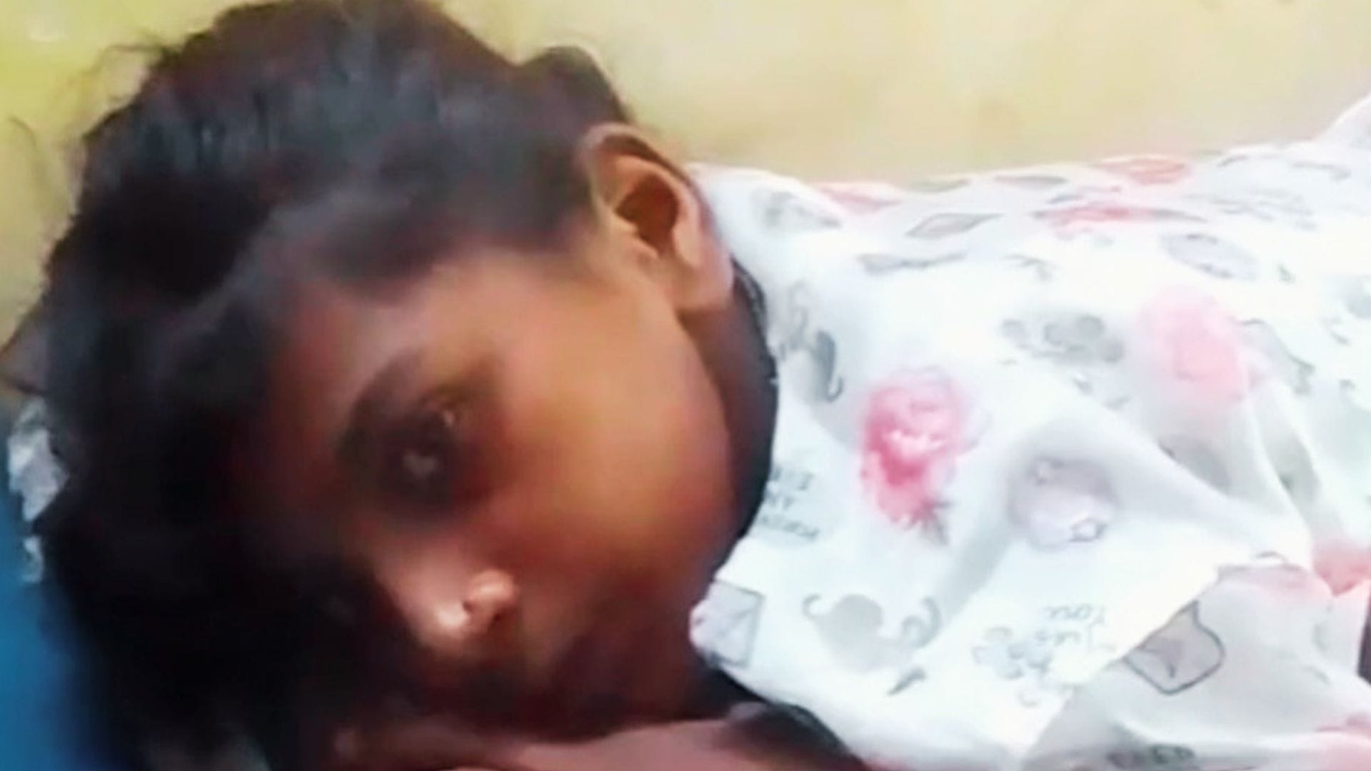 प्रियंका की पीठ पर दिखा सूजन।