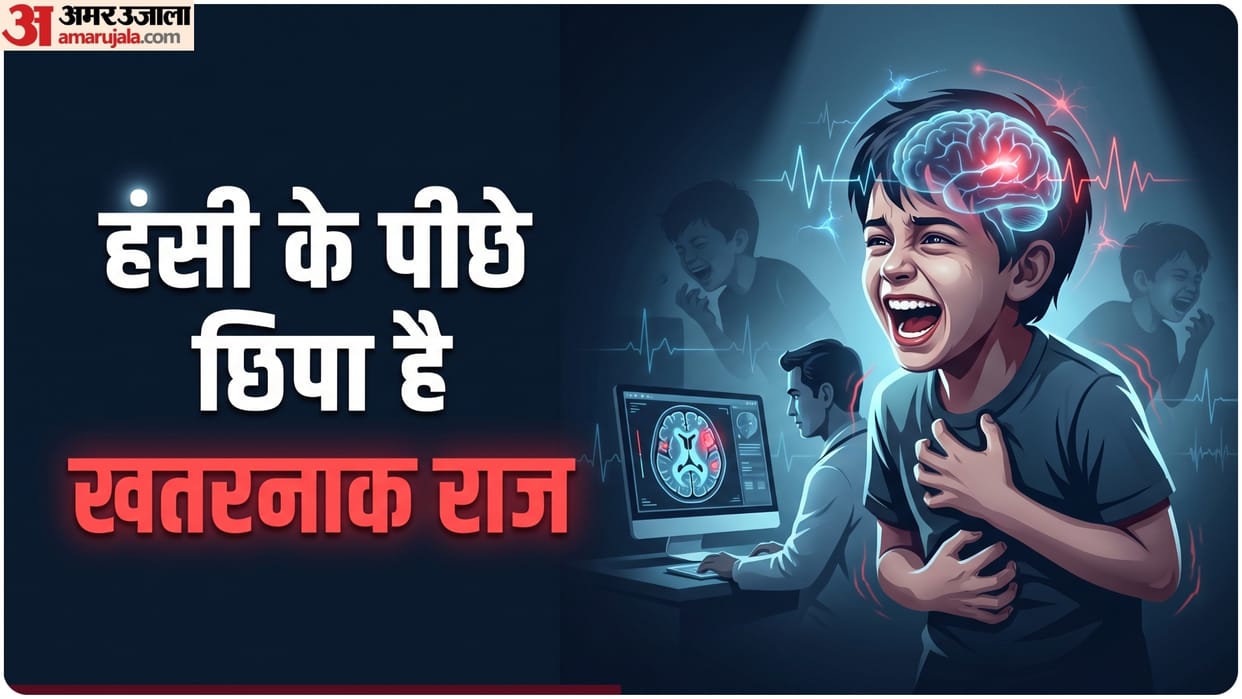 what is gelastic seizure laughing seizure know its symptoms causes and treatment in hindi