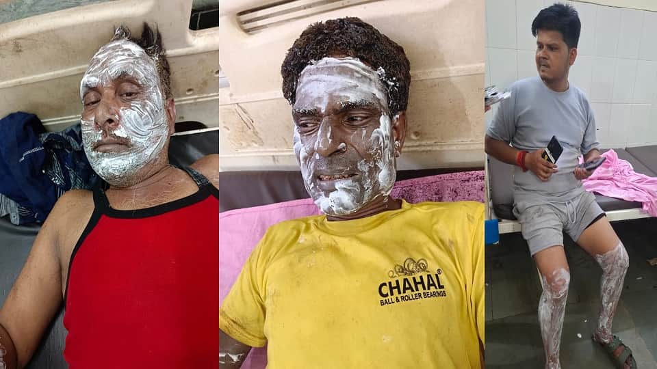 आग से झुलसे हुए लोग