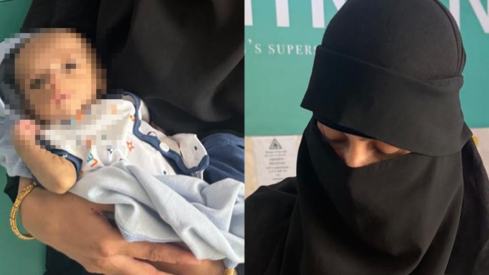 Intestines exposed, unable to feed... Newborn's life saved after 85 days of intravenous nutrition.