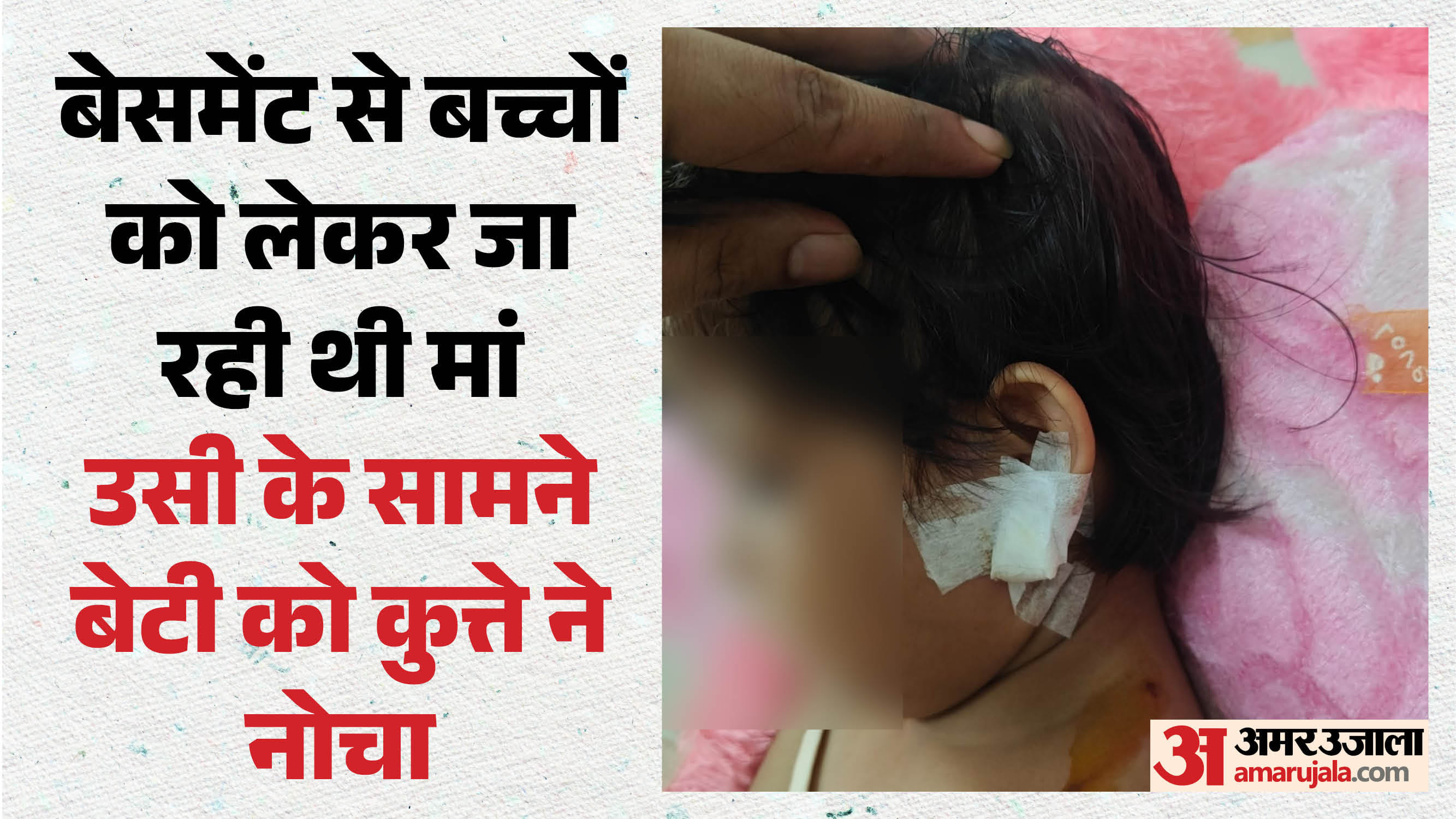 बच्ची को कुत्ते ने नोचा