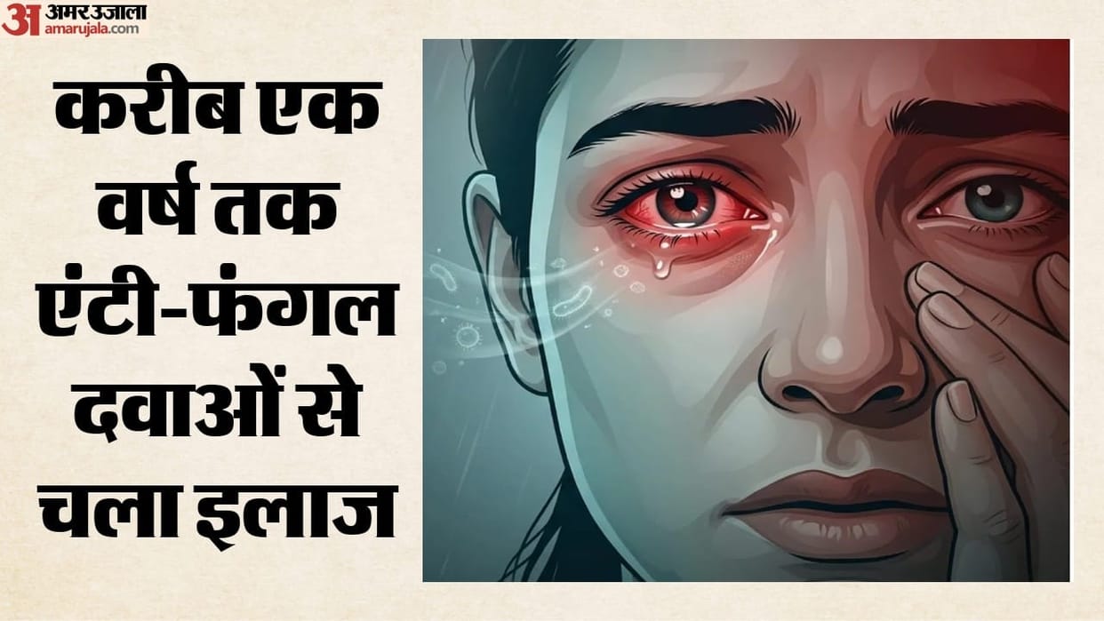 Gurugram woman develops rare fungal eye infection