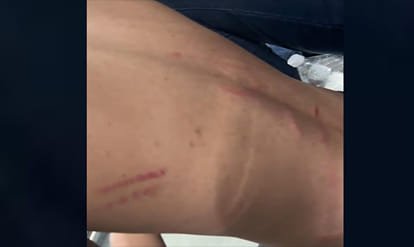 Kanpur: Four injured after being beaten with iron rods in parking dispute