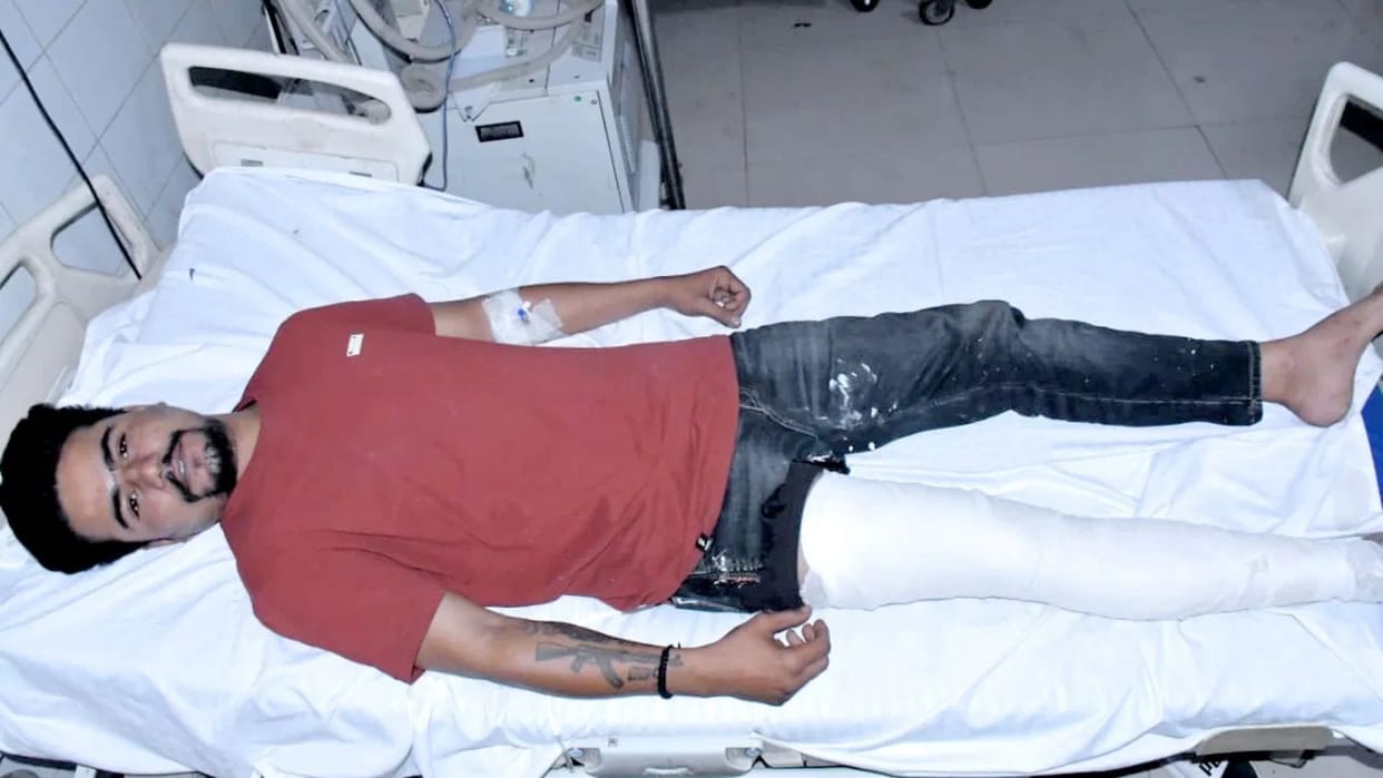 A miscreant, out to kill an accused in murder case, opened fire at police, he sustained a gunshot wound to leg
