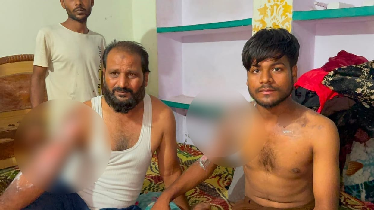 Kanpur Objecting slap proves costly boiling tea thrown at family three people including elderly woman scalded