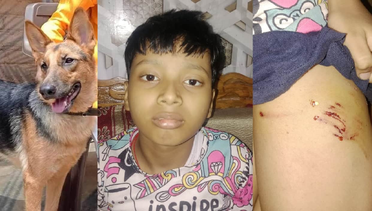 Kanpur German Shepherd attacks 5th grade student biting his thigh while he was returning from coaching