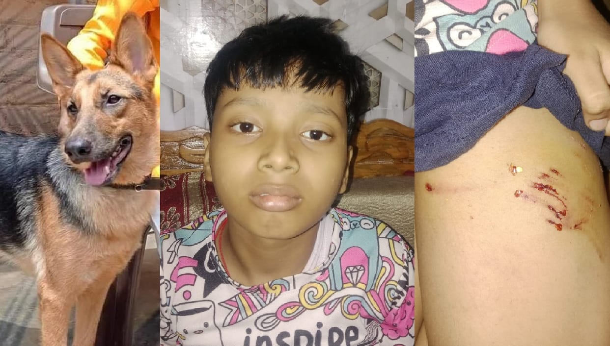 Kanpur German Shepherd attacks 5th grade student biting his thigh while he was returning from coaching