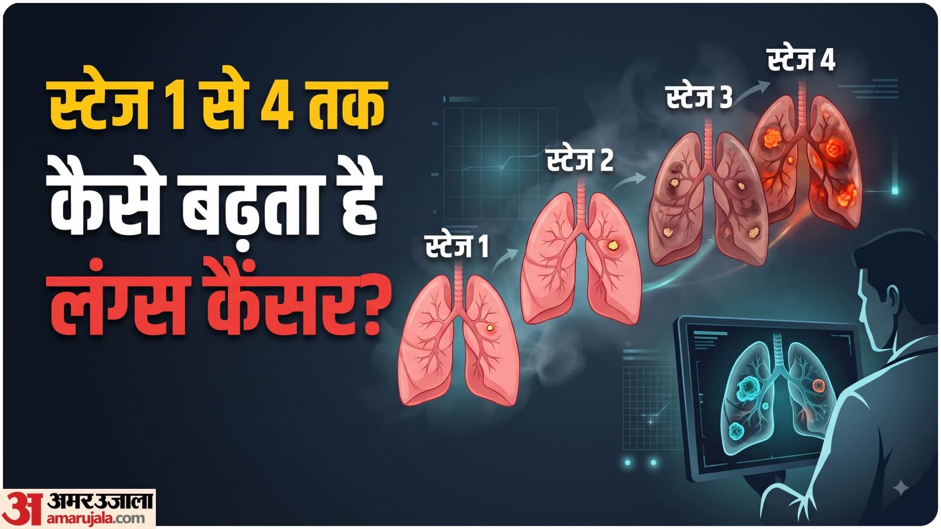 फेफड़ों के कैंसर के मामले