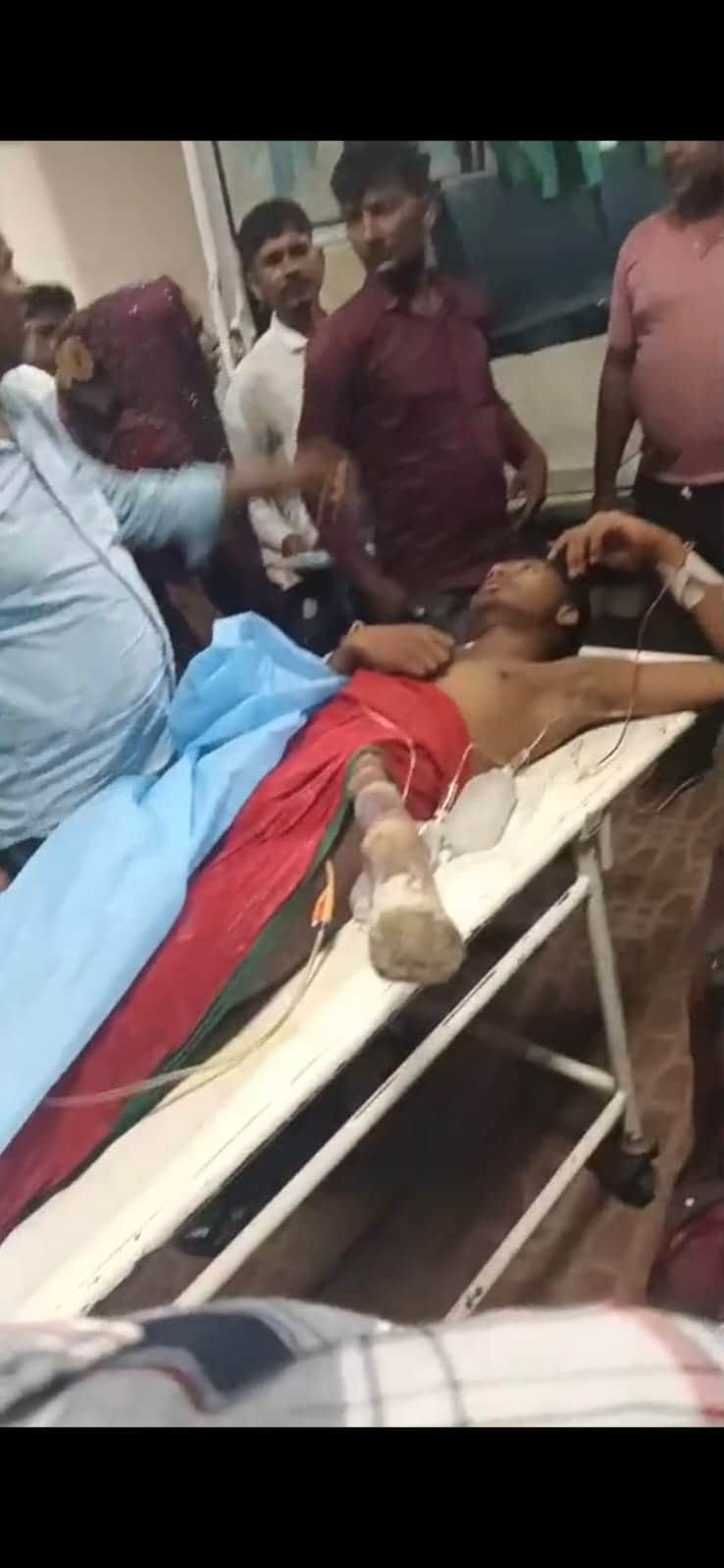 नौवीं के छात्र के पेट में घुसी लाठी