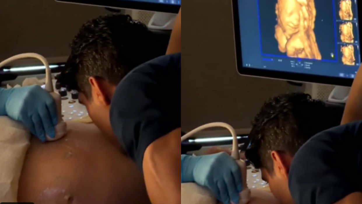 Unborn baby smiles after hearing father voice during ultrasound scan viral video