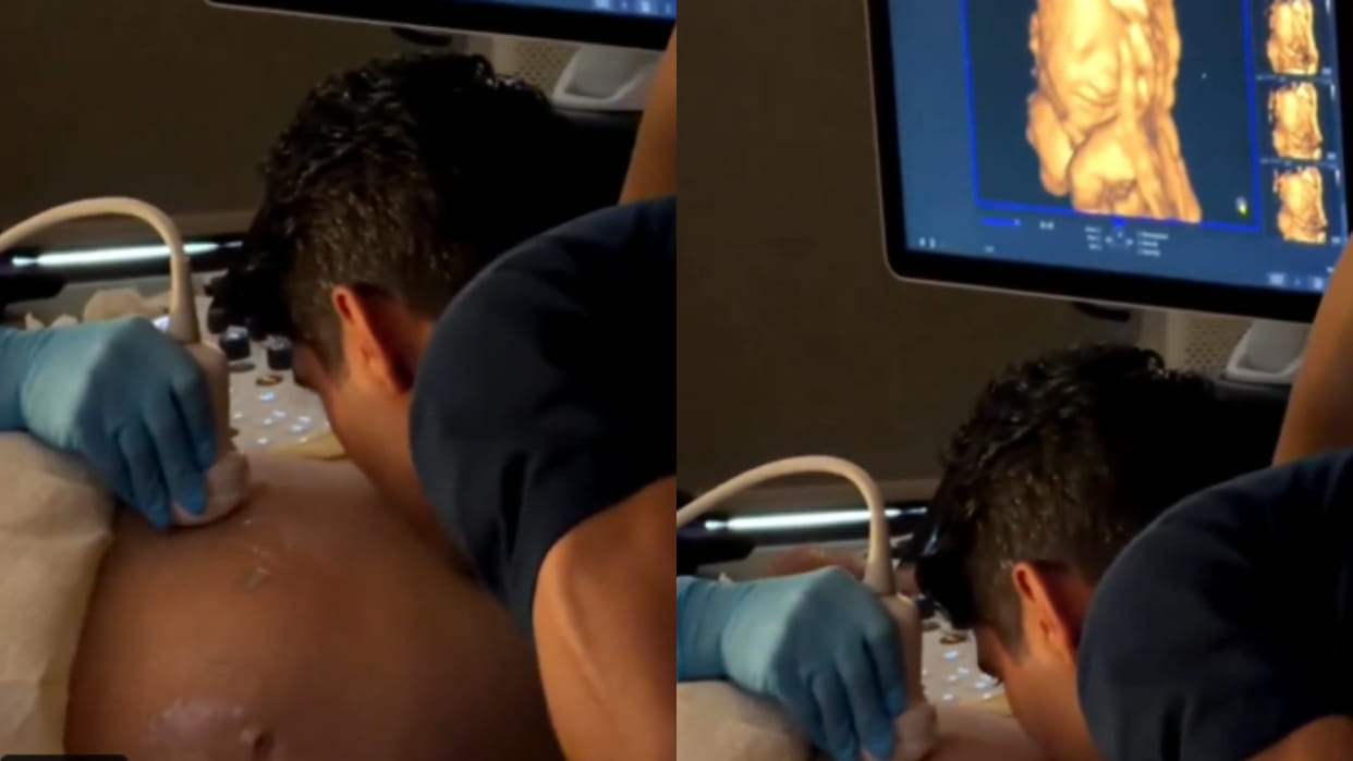 Unborn baby smiles after hearing father voice during ultrasound scan viral video