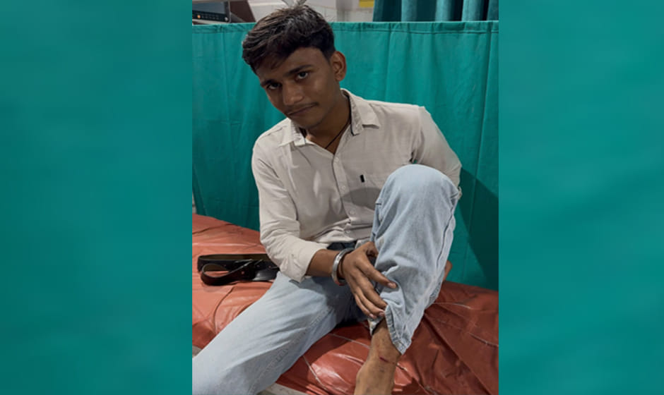 Kanpur: Dogs surround and attack student on a motorcycle, injuring him with bites