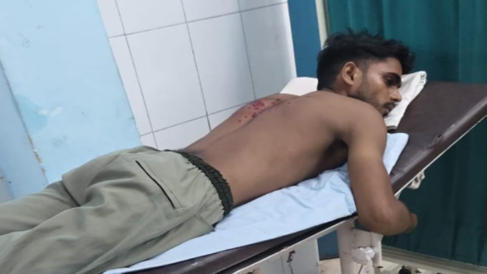 Meerut Youth Shot at While Returning Home, Injured by Pellet Shots; FIR Against Unknown Attacker