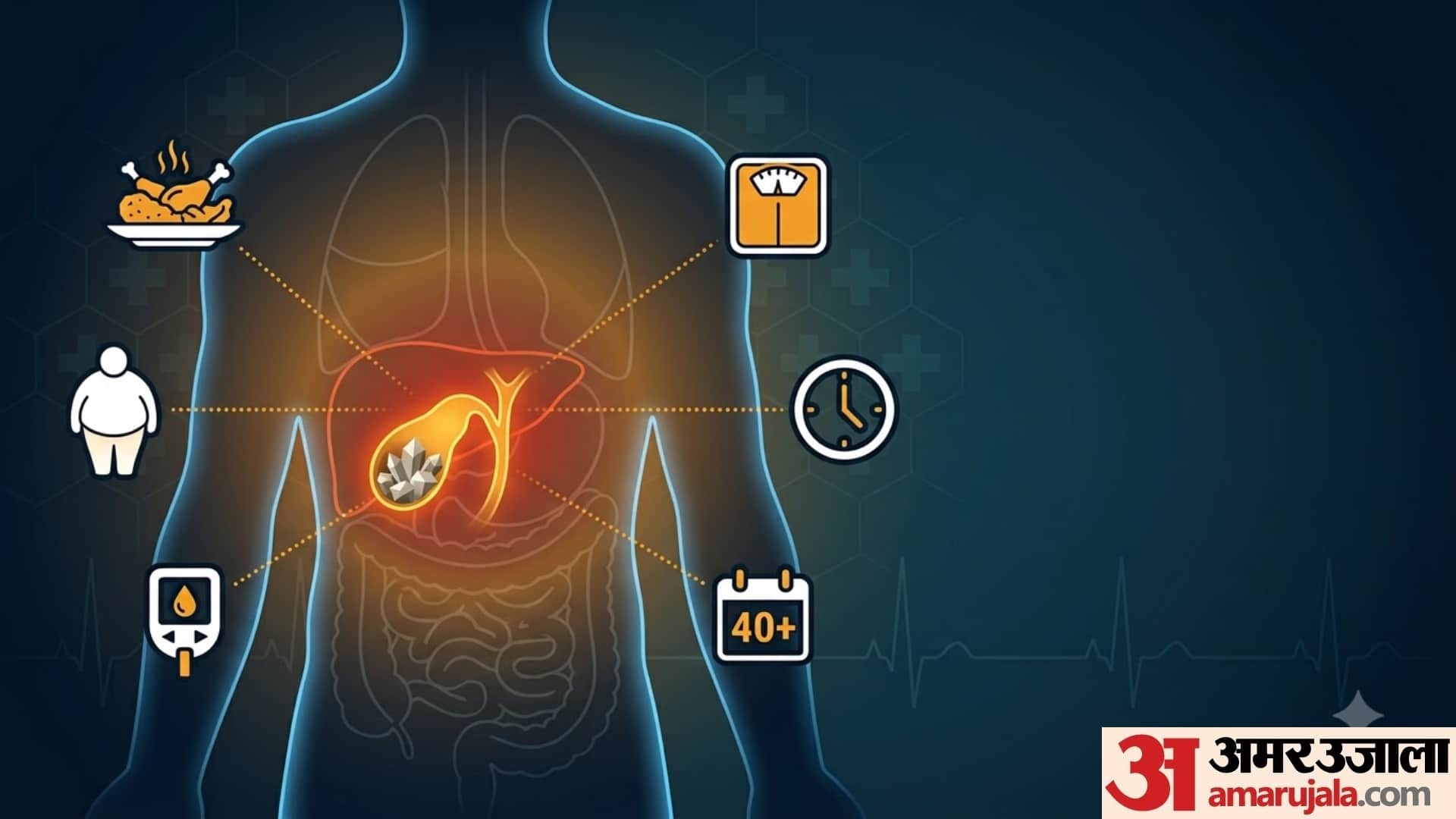 cause of gallbladder stone and its treatment in hindi gallbladder stone kaise banta hai