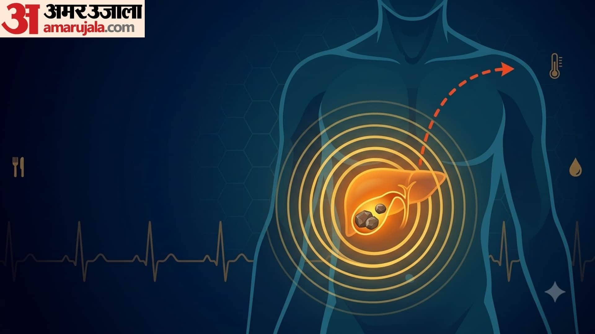 cause of gallbladder stone and its treatment in hindi gallbladder stone kaise banta hai
