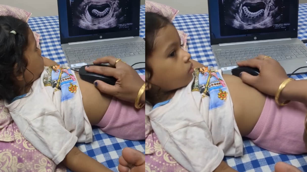 Mother played fake ultrasound prank on her daughter to teaching a Lesson viral video