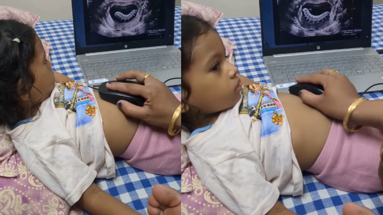 Mother played fake ultrasound prank on her daughter to teaching a Lesson viral video