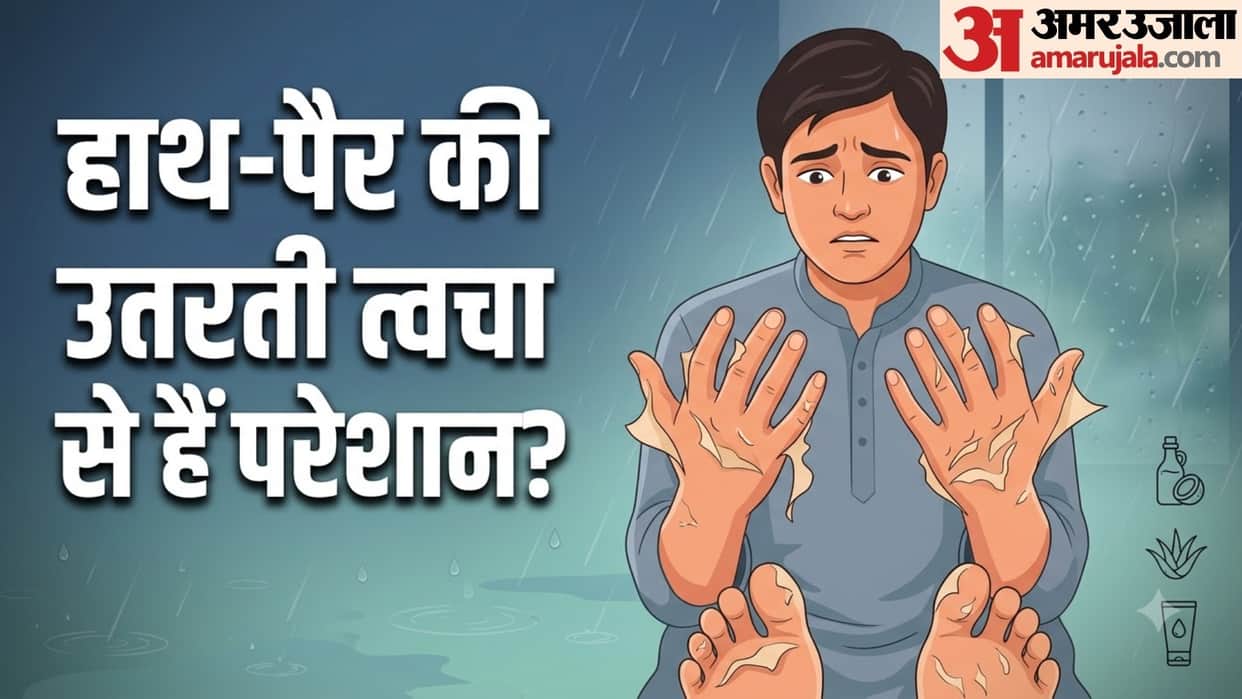 monsoon skin care skin peeling on hands and feet treatment at home in hindi