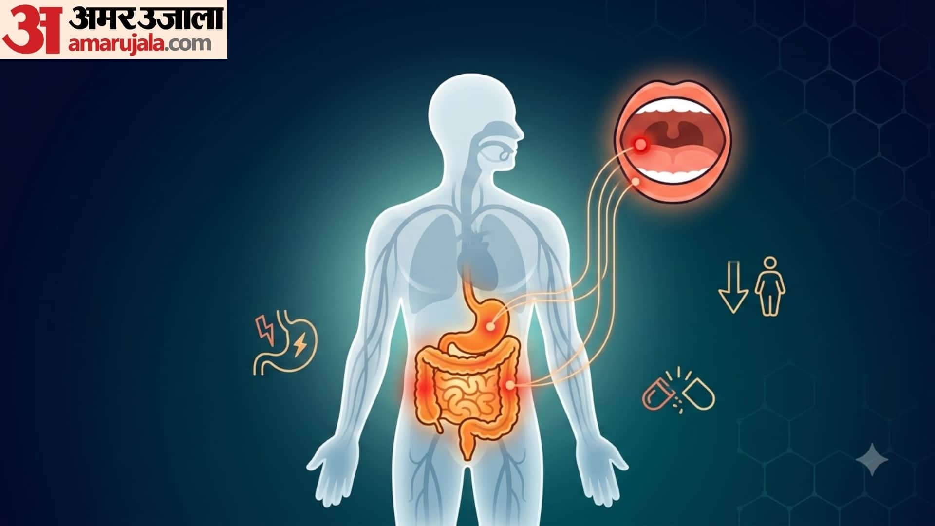 mouth ulcer causes in hindi muh me baar baar chale kyu hote hai