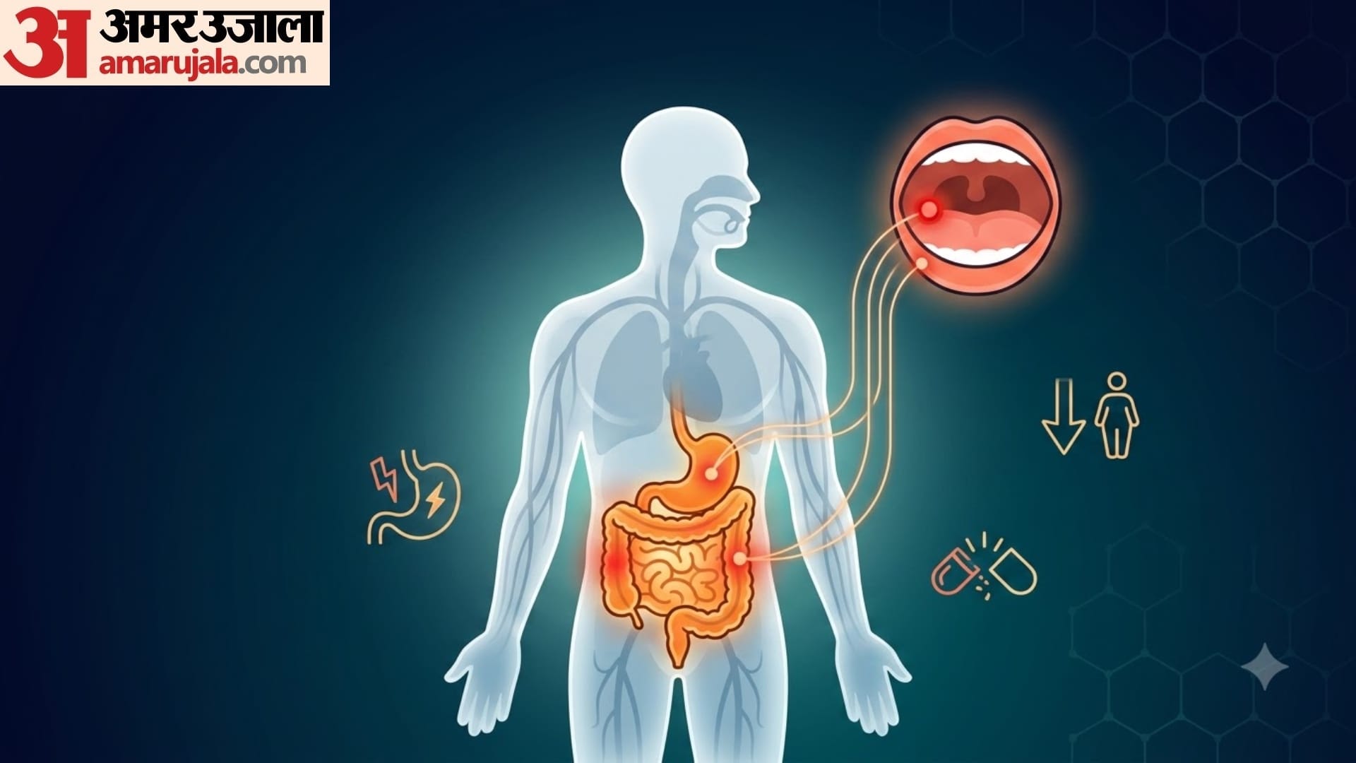 mouth ulcer causes in hindi muh me baar baar chale kyu hote hai