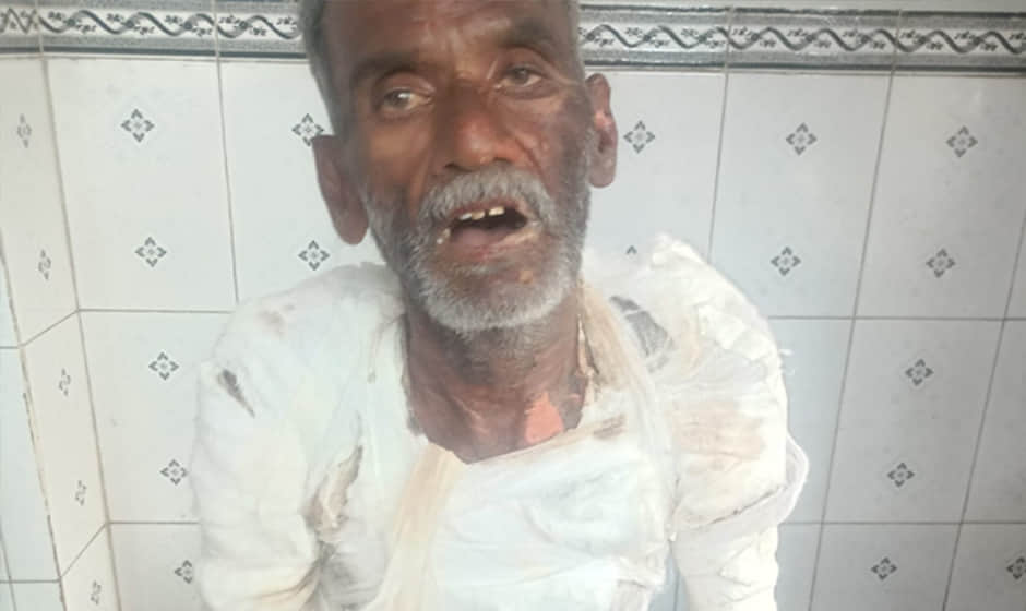Daughter-in-law pours boiling hot water on father-in-law for refusing to transfer land in her name