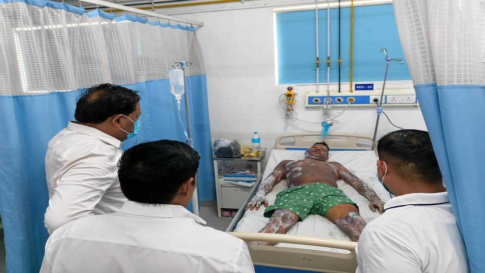 Father and two children suffer burn injuries after gas leaks from cylinder while cooking Maggi in rudrapur