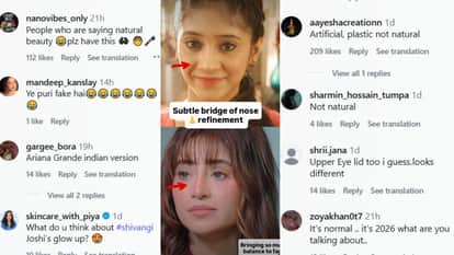 Shivangi Joshi Tv Actress Undergo Cosmetic Procedure Claim Went Viral