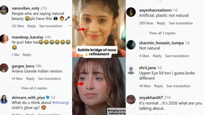 Shivangi Joshi Tv Actress Undergo Cosmetic Procedure Claim Went Viral