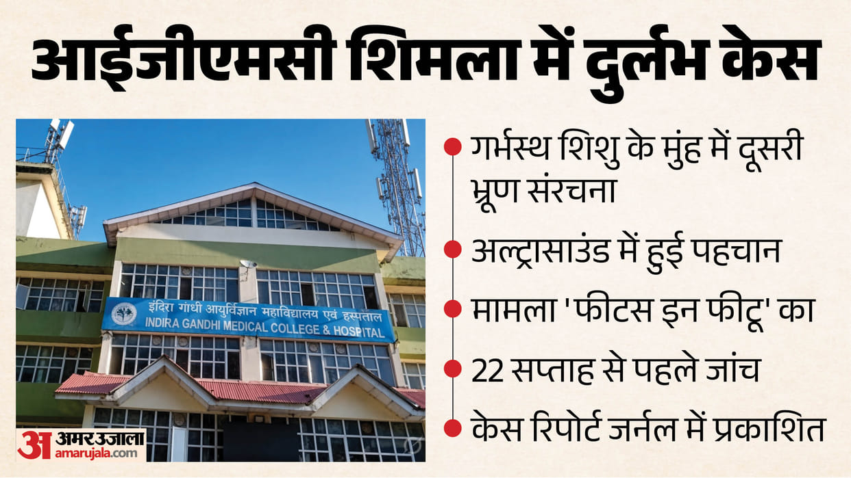igmc shimla rare fetus in fetu oral case