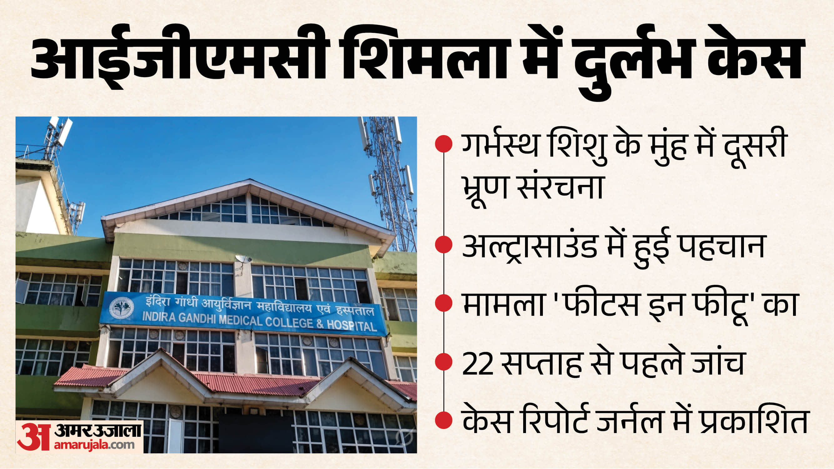 आईजीएमसी में दुर्लभ केस।