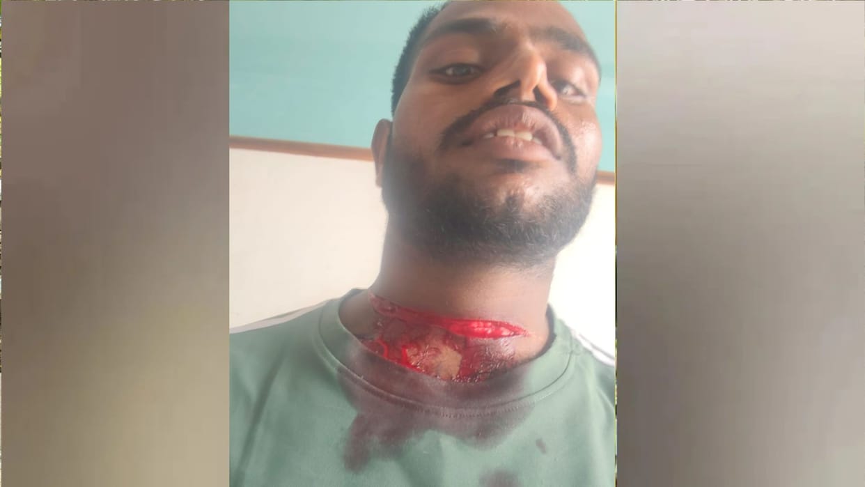 Manjha gets caught around the neck of a youth on his way to sell milk; his life is saved.