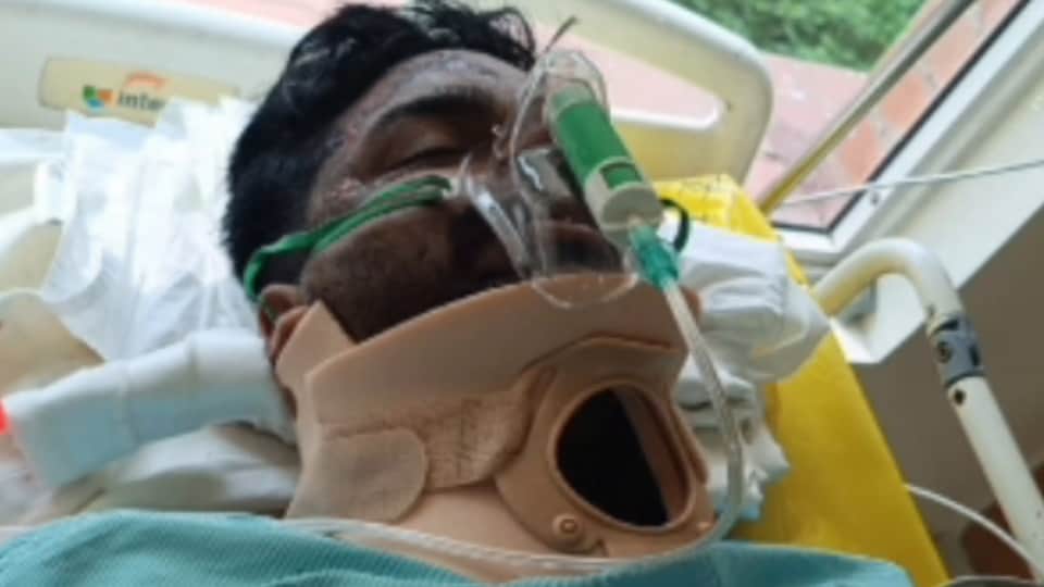 Accident in Moga Speeding bus hits motorcycle rider loses leg