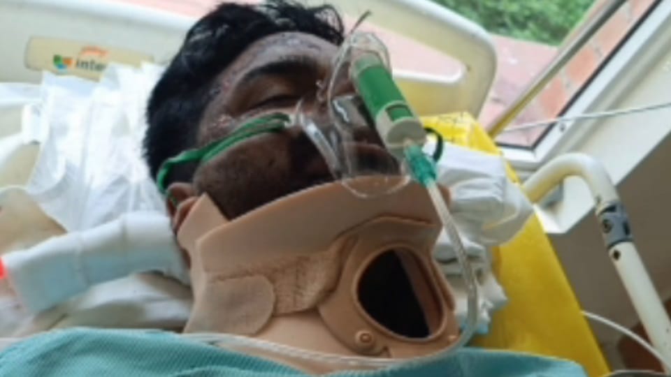 Accident in Moga Speeding bus hits motorcycle rider loses leg