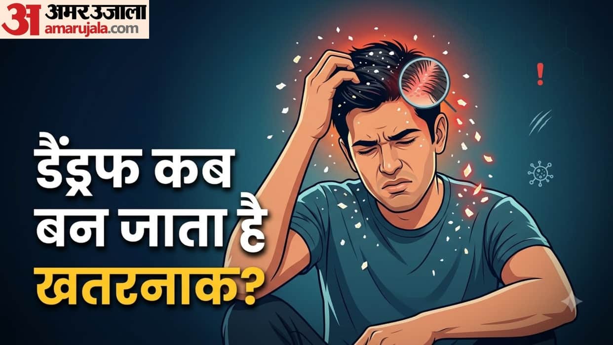 dangerous dandruff signs In hindi jyada dandruff hone ke nuksan