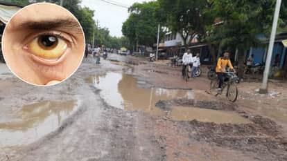 बरसात में जलजनित बीमारियों का खतरा बढ़ा