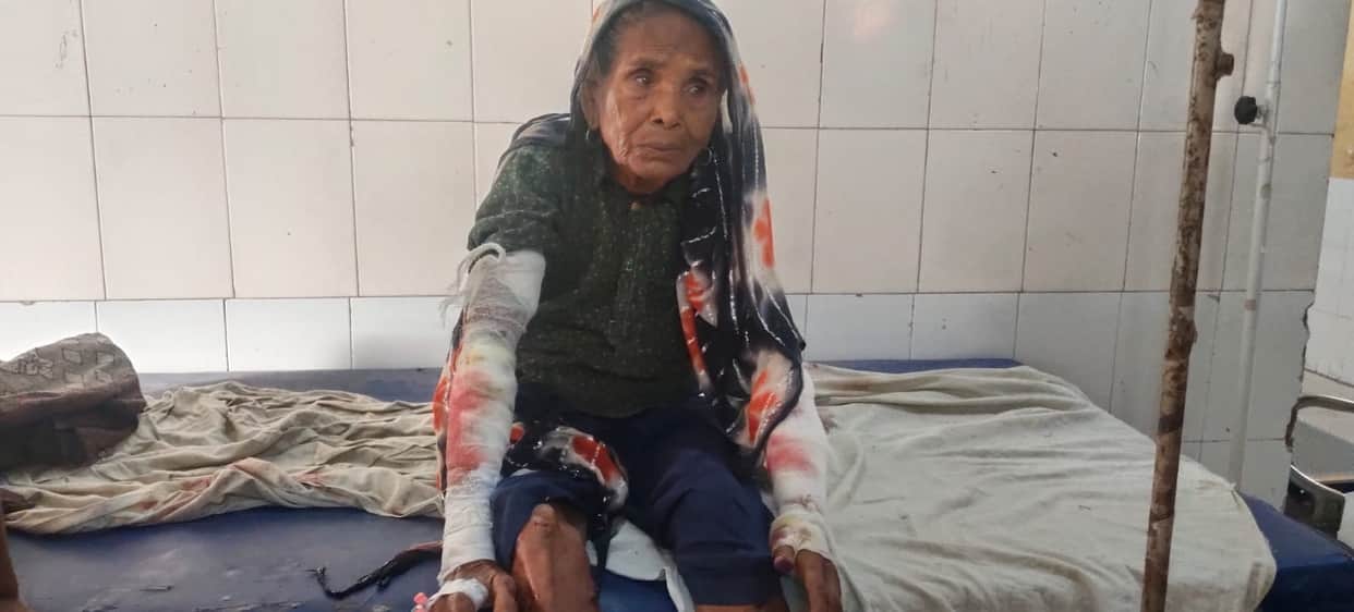 Bahraich: Leopard attacks 80-year-old woman sleeping in courtyard; mauls both her hands.