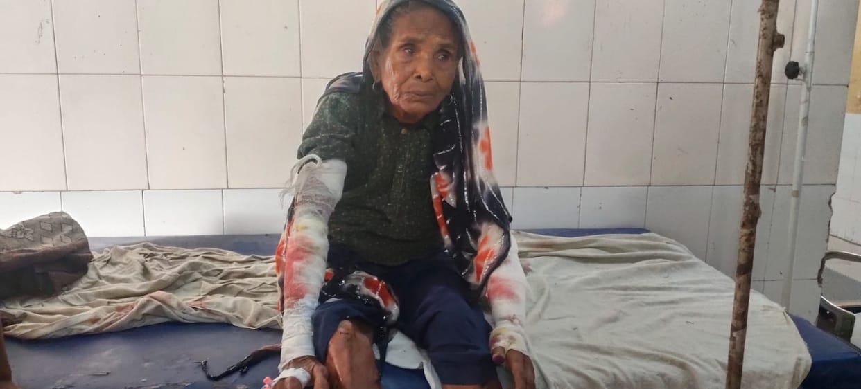 Bahraich: Leopard attacks 80-year-old woman sleeping in courtyard; mauls both her hands.