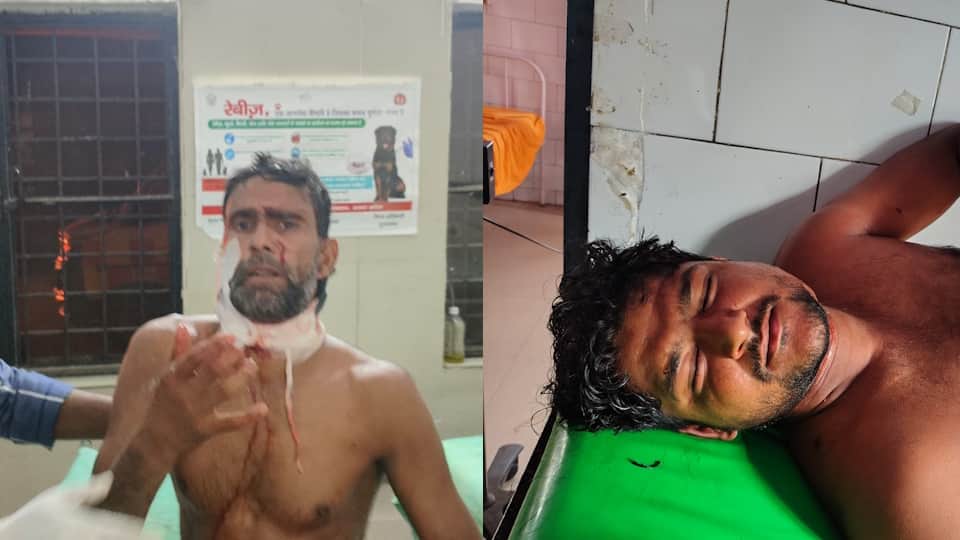 Moradabad Leopard Attack Farmer Pushpendra Rescued Just in Time Suffers 7 Injuries UP News in Hindi