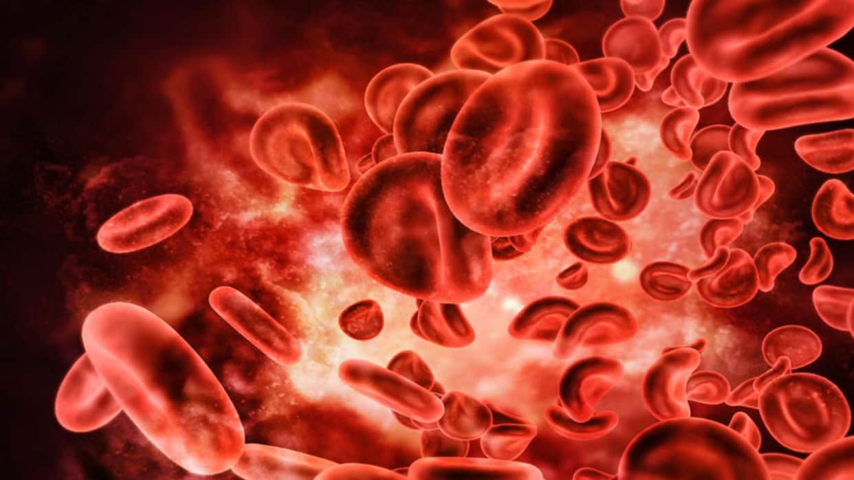 Sickle Cell Report MP and Odisha Account for Nearly 59 percent of India Total Cases