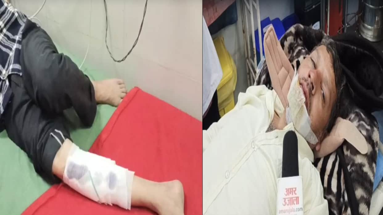 Eight injured in the Sangrah accident have arrived at Medical College Nahan; lack of healthcare facilities has