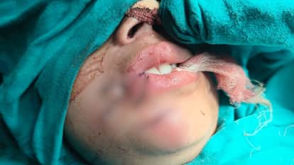 brown dog bit uncle picked me Child admitted hospital recounts incident BHU VC checks on condition