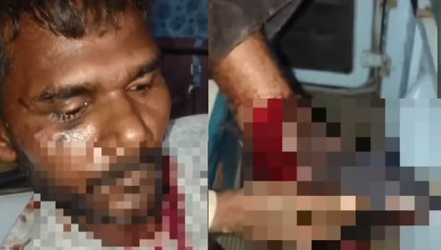 Kanpur Contractor held hostage in an auto rickshaw and robbed struck with a sickle and dumped on GT Road