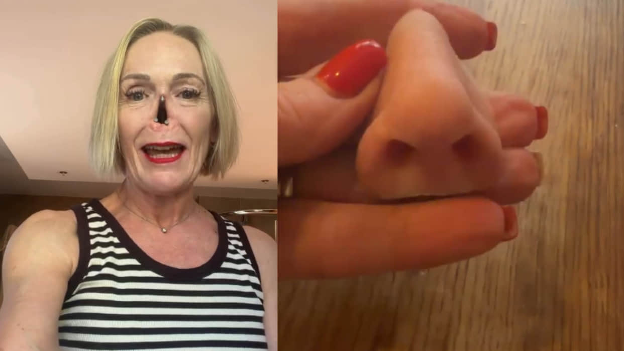 British woman has three magnets on her face changes her nose as per her choice viral video