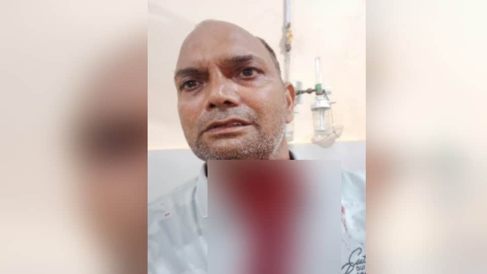 Baghpat: Man’s Neck Cut by Kite String While Riding Bike, Hospitalized After Accident